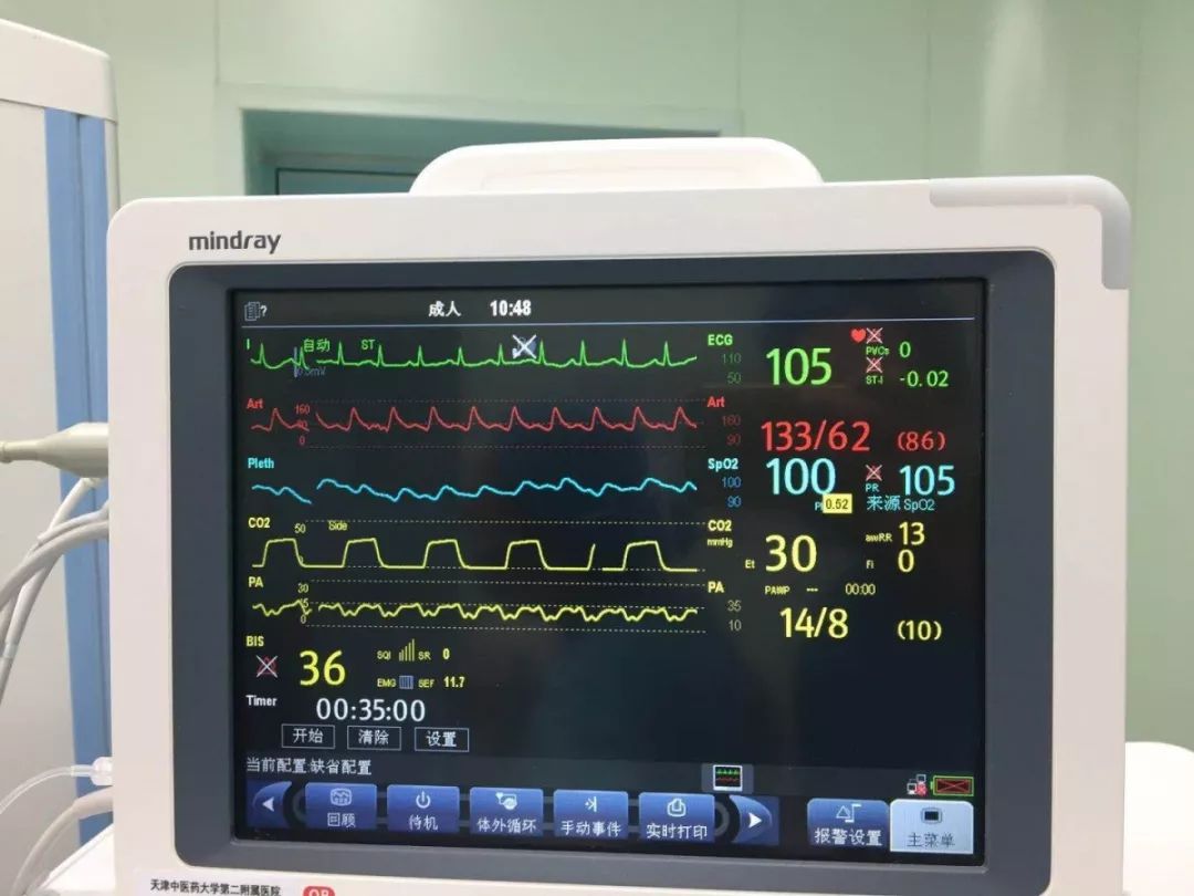 术中监测各指标基本平稳正常